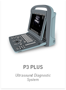 Ultrasound Diagnostic System