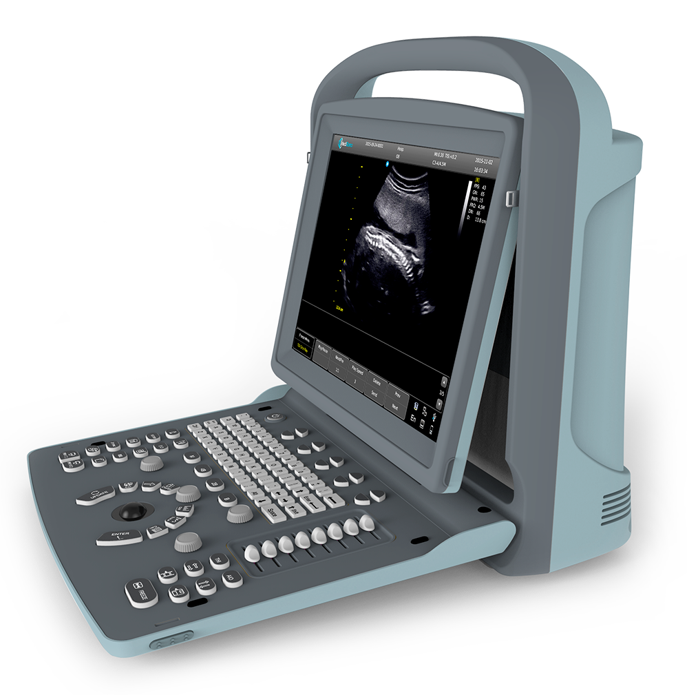 Medisono Ultrasound Diagnostic System